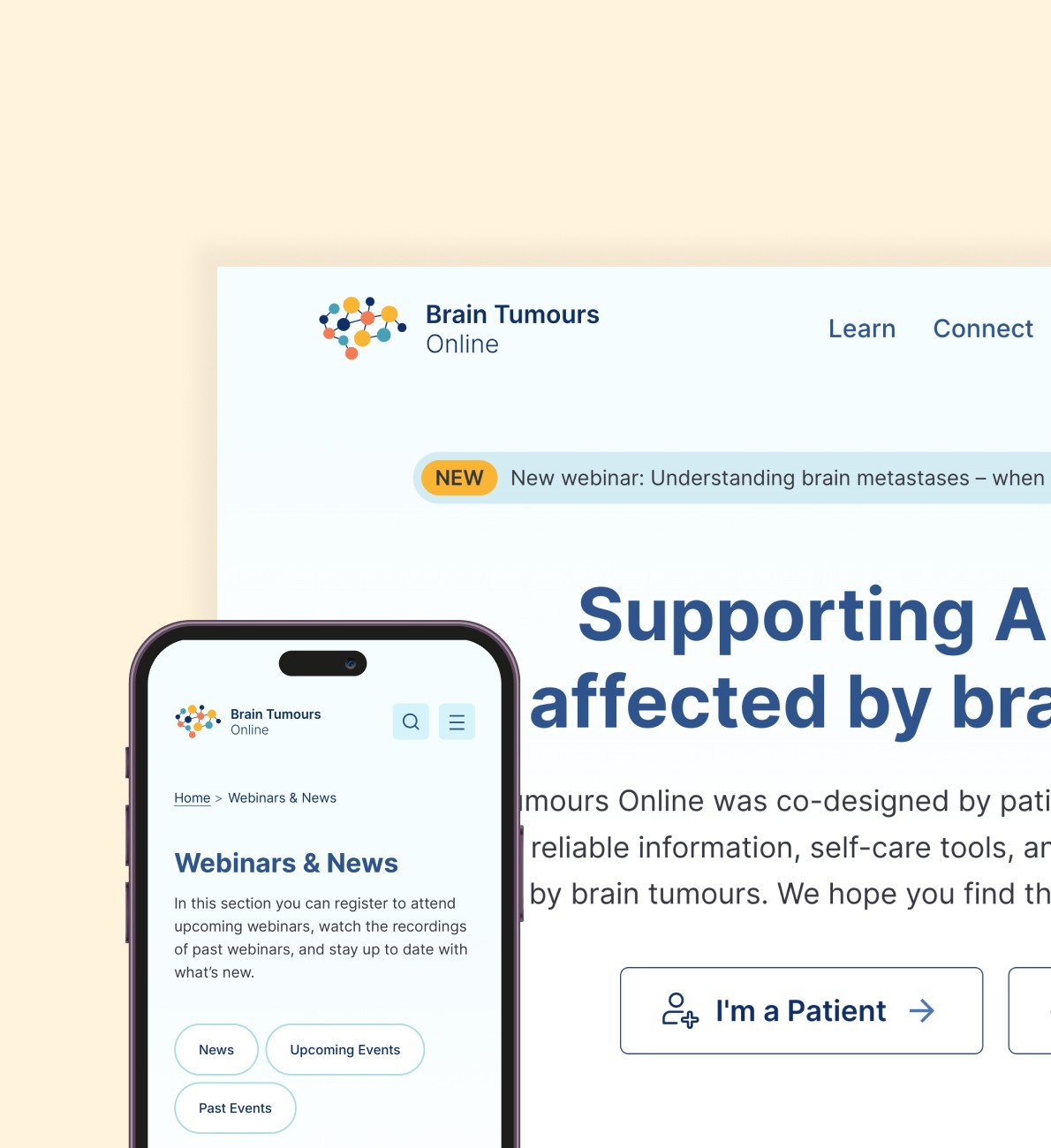 Brain tumours online leader